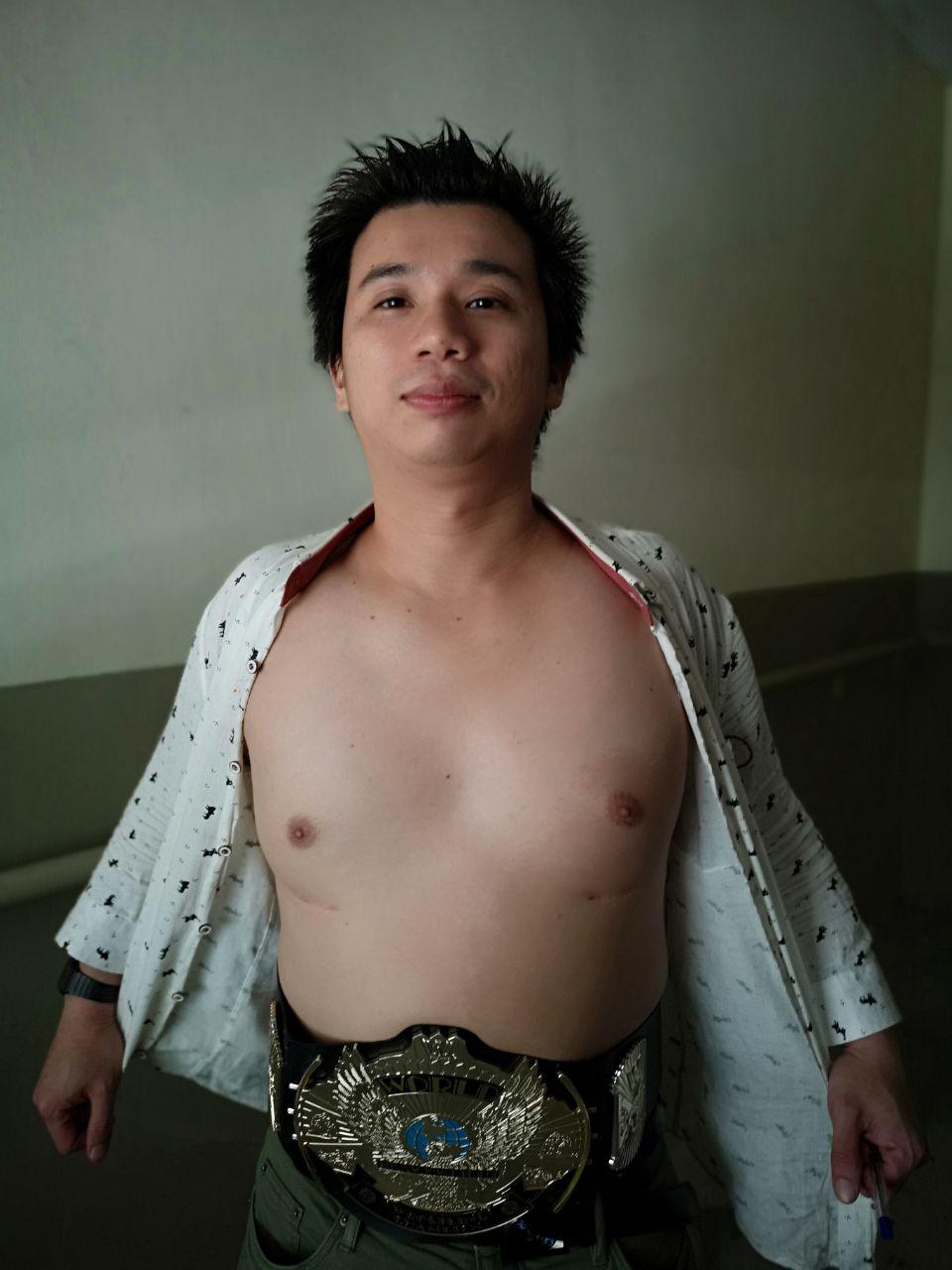Rice-Media-Kurt-Tay-Father-Shemale-Breast-Implant-2 Rice-Media-Kurt-Tay-Father-Shemale-Breast-Implant-2